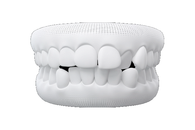 Hayal Ettiğiniz Dişlere <br><strong>Dent Estetica İle Ulaşın</strong>